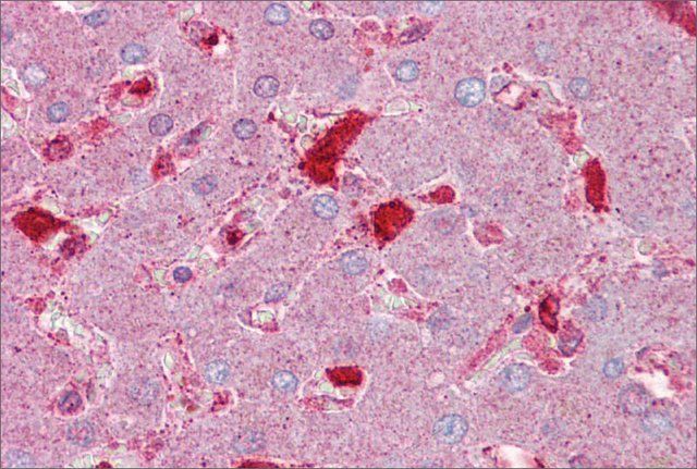 Anti-SERPINC1 antibody produced in rabbit