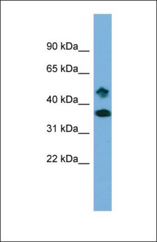 Anti-SETD6 antibody produced in rabbit