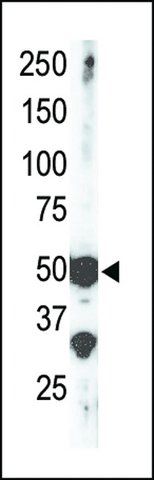 ANTI-SET7 (SET9) (CENTER) antibody produced in rabbit