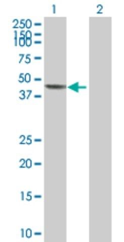 Anti-SERPINE1 antibody produced in mouse