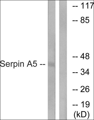 Anti-Serpin A5 antibody produced in rabbit