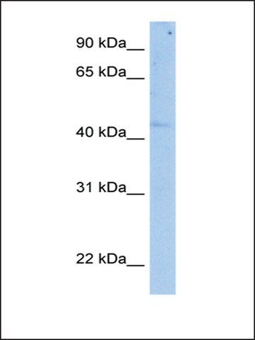 Anti-SETD7 antibody produced in rabbit