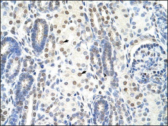 Anti-SF1 antibody produced in rabbit