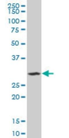 ANTI-SIX3 antibody produced in mouse