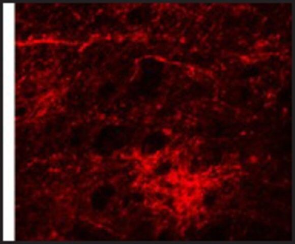 Anti-SIPA1L3 antibody produced in rabbit