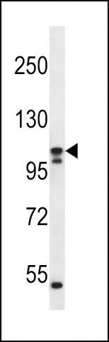 ANTI-SLC12A6(N-TERMINAL) antibody produced in rabbit