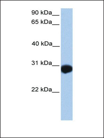 Anti-SLAMF6 (AB1) antibody produced in rabbit