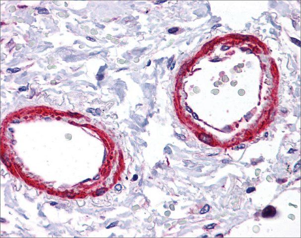 Anti-SIRT5 antibody produced in rabbit