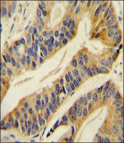 ANTI-SLC16A11 (N-TERM) antibody produced in rabbit