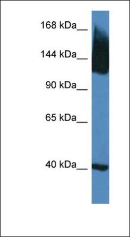 Anti-SLC12A5 antibody produced in rabbit