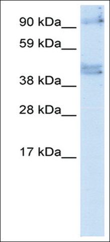 Anti-SIRT2 (AB1) antibody produced in rabbit