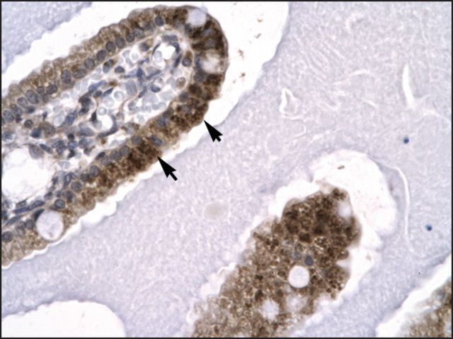 Anti-SKIIP antibody produced in rabbit