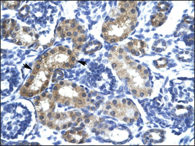 Anti-SIX6 antibody produced in rabbit