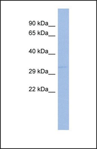 Anti-SIX1 antibody produced in rabbit