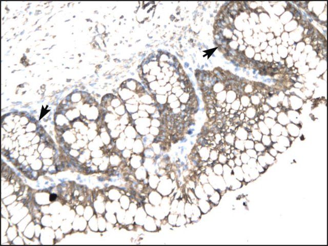 Anti-SLC17A2 antibody produced in rabbit