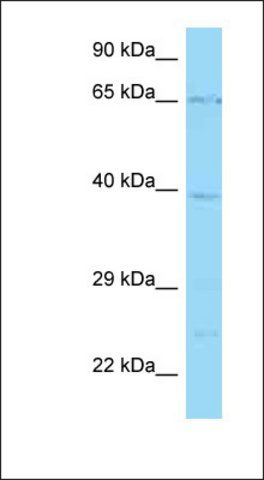 Anti-SLC22A5 antibody produced in rabbit