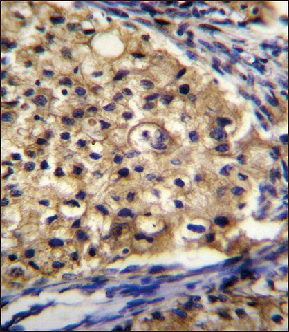 ANTI-SLC16A13 (C-TERM) antibody produced in rabbit