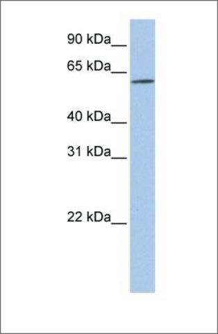 Anti-SLC22A14 antibody produced in rabbit