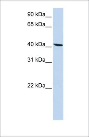 Anti-SLC22A18