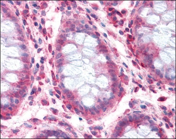 Anti-SLC1A4 antibody produced in rabbit