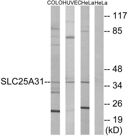 Anti-SLC25A31 antibody produced in rabbit