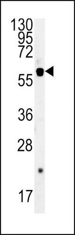 ANTI-SLC16A9 (CENTER) antibody produced in rabbit