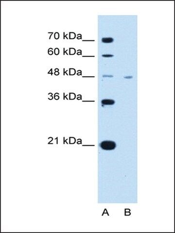 Anti-SLC16A1