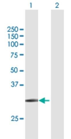 Anti-SLC14A1 antibody produced in mouse