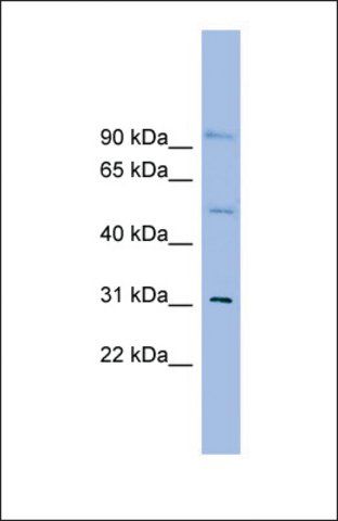 Anti-SLC25A25, (N-terminal) antibody produced in rabbit