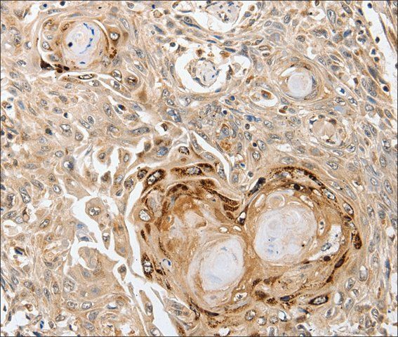 Anti-SLC1A7 antibody produced in rabbit