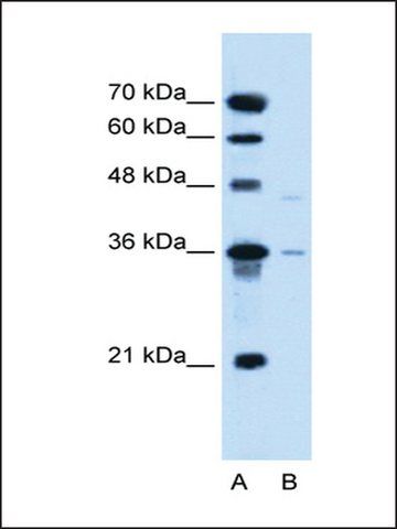 Anti-SLC17A3 antibody produced in rabbit