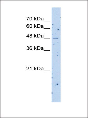 Anti-SLC22A23 antibody produced in rabbit