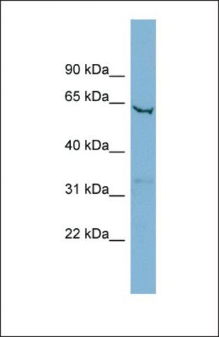 Anti-SLC25A21 antibody produced in rabbit