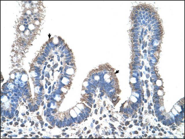 Anti-SLC22A1 (AB2) antibody produced in rabbit