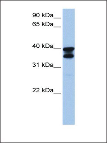 Anti-SLC25A31 antibody produced in rabbit