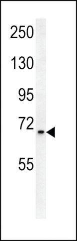 ANTI-SLC25A12(N-TERMINAL) antibody produced in rabbit