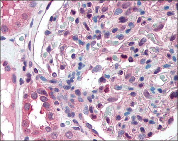 Anti-SLC39A14 antibody produced in rabbit