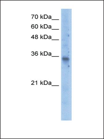 Anti-SLC25A16 antibody produced in rabbit