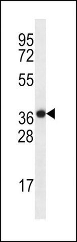 ANTI-SLC38A8 (CENTER) antibody produced in rabbit