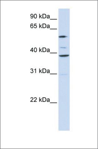 Anti-SLC25A16 antibody produced in rabbit