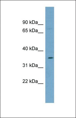 Anti-SLC39A2, (N-terminal) antibody produced in rabbit