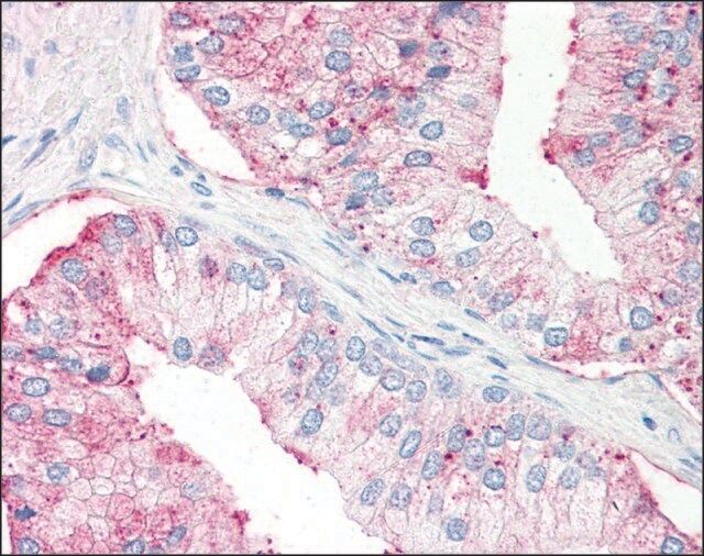 Anti-SLC39A14 antibody produced in rabbit