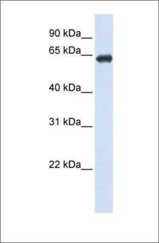 Anti-SLC39A4 antibody produced in rabbit