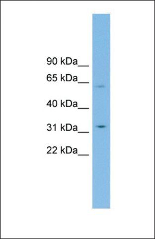 Anti-SLC39A9 antibody produced in rabbit