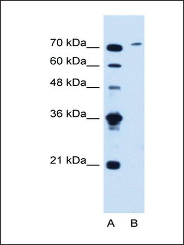 Anti-SLCO6A1 (AB2) antibody produced in rabbit