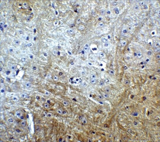 Anti-SLITRK1 antibody produced in rabbit