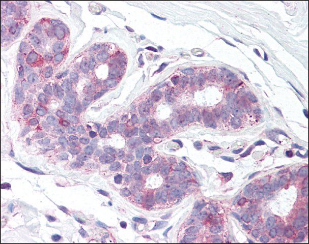 Anti-SLC39A6 antibody produced in rabbit