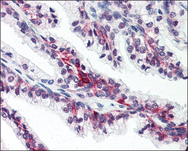 Anti-SLC39A6 antibody produced in rabbit