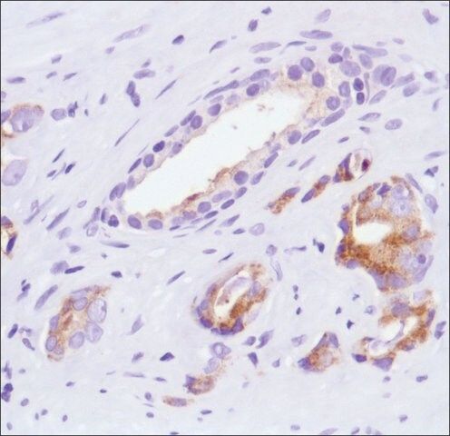 Anti-SLIT2 antibody, Rabbit monoclonal