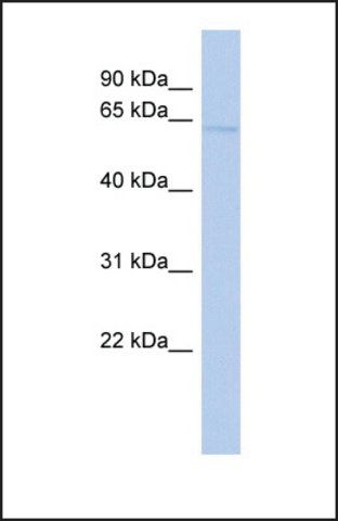 Anti-SLC39A4 antibody produced in rabbit